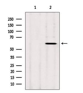 CYP26B1 Antibody - Western blot analysis of extracts of rat heart tissue using CYP26B1 antibody. Lane 1 was treated with the blocking peptide.