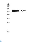 CYP26B1 Antibody - Western Blot (WB) analysis of Mouse Brain cells using Antibody diluted at 1:800.