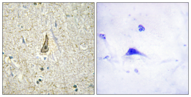 CYP26C1 Antibody - Immunohistochemistry analysis of paraffin-embedded human brain, using Cytochrome P450 26C1 Antibody. The picture on the right is blocked with the synthesized peptide.