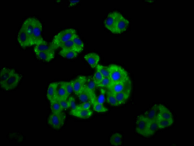 CYP26C1 Antibody - Immunofluorescence staining of HepG2 cells diluted at 1:166, counter-stained with DAPI. The cells were fixed in 4% formaldehyde, permeabilized using 0.2% Triton X-100 and blocked in 10% normal Goat Serum. The cells were then incubated with the antibody overnight at 4°C.The Secondary antibody was Alexa Fluor 488-congugated AffiniPure Goat Anti-Rabbit IgG (H+L).