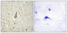 CYP26C1 Antibody - Peptide - + Immunohistochemistry analysis of paraffin-embedded human brain tissue using Cytochrome P450 26C1 antibody.