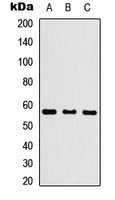 CYP26C1 Antibody - Western blot analysis of Cytochrome P450 26C1 expression in HEK293T (A); Raw264.7 (B); H9C2 (C) whole cell lysates.