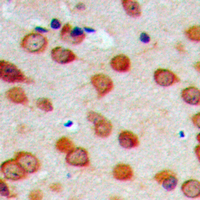 CYP26C1 Antibody - Immunohistochemical analysis of Cytochrome P450 26C1 staining in human brain formalin fixed paraffin embedded tissue section. The section was pre-treated using heat mediated antigen retrieval with sodium citrate buffer (pH 6.0). The section was then incubated with the antibody at room temperature and detected using an HRP conjugated compact polymer system. DAB was used as the chromogen. The section was then counterstained with hematoxylin and mounted with DPX.