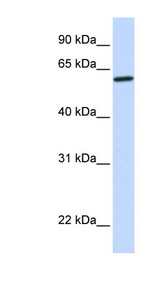 CYP27 / CYP27A1 Antibody - CYP27A1 antibody Western blot of Fetal Brain lysate. This image was taken for the unconjugated form of this product. Other forms have not been tested.