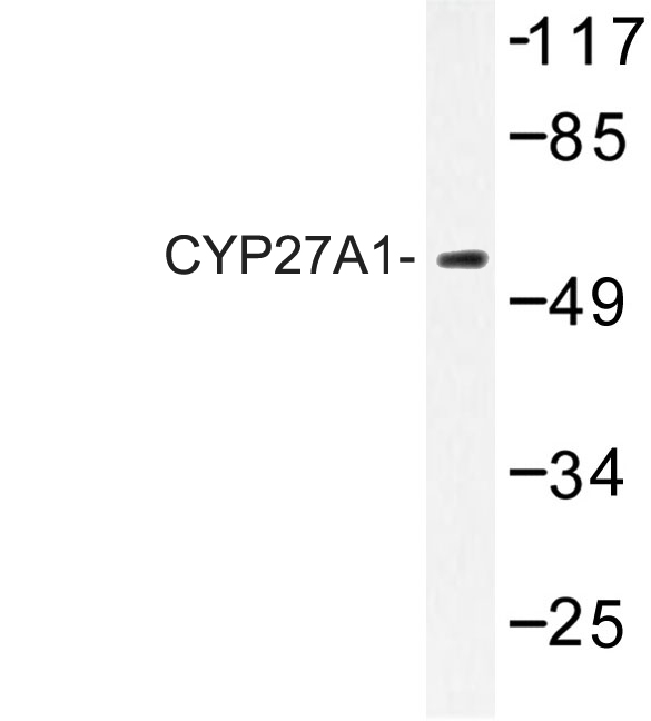 CYP27 / CYP27A1 Antibody - Western blot of CYP27A1 (E131) pAb in extracts from HeLa cells.