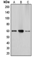CYP27 / CYP27A1 Antibody - Western blot analysis of Cytochrome P450 27A1 expression in HepG2 (A); Caco2 (B); A549 (C) whole cell lysates.