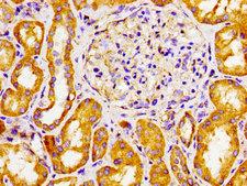 CYP27 / CYP27A1 Antibody - Immunohistochemistry image of paraffin-embedded human kidney tissue at a dilution of 1:100