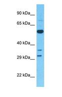 CYP27 / CYP27A1 Antibody - Western blot of CYP27A1 Antibody with human Fetal Liver lysate.  This image was taken for the unconjugated form of this product. Other forms have not been tested.