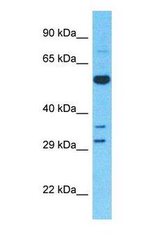 CYP27 / CYP27A1 Antibody - Western blot of CYP27A1 Antibody with human Fetal Liver lysate.  This image was taken for the unconjugated form of this product. Other forms have not been tested.