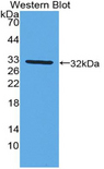 CYP27B1 Antibody - Western blot of recombinant CYP27B1.