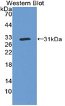 CYP27B1 Antibody - Western blot of recombinant CYP27B1.