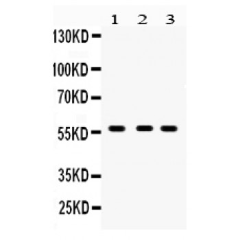 CYP27B1 Antibody - CYP27B1 antibody Western blot. All lanes: Anti CYP27B1 at 0.5 ug/ml. Lane 1: Rat Kidney Tissue Lysate at 50 ug. Lane 2: Mouse Kidney Tissue Lysate at 50 ug. Lane 3: 293T Whole Cell Lysate at 40 ug. Predicted band size: 57 kD. Observed band size: 57 kD.