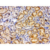 CYP27B1 Antibody - CYP27B1 antibody IHC-paraffin. IHC(P): Rat Kidney Tissue.
