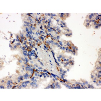 CYP27B1 Antibody - CYP27B1 antibody IHC-paraffin. IHC(P): Human Kidney Cancer Tissue.