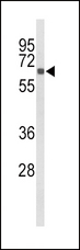 CYP27B1 Antibody - Western blot of CYP27B1 Antibody in mouse kidney tissue lysates (35 ug/lane). CYP27B1 (arrow) was detected using the purified antibody.