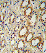 CYP27B1 Antibody - CYP27B1 Antibody immunohistochemistry of formalin-fixed and paraffin-embedded human kidney tissue followed by peroxidase-conjugated secondary antibody and DAB staining.