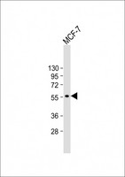 CYP27B1 Antibody - Anti-CYP27B1 Antibody (C-term) at 1:1000 dilution + MCF-7 whole cell lysate Lysates/proteins at 20 µg per lane. Secondary Goat Anti-mouse IgG, (H+L), Peroxidase conjugated at 1/10000 dilution. Predicted band size: 57 kDa Blocking/Dilution buffer: 5% NFDM/TBST.