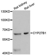 CYP27B1 Antibody - Western blot analysis of extracts of various cell lines, using CYP27B1 antibody at 1:3000 dilution. The secondary antibody used was an HRP Goat Anti-Rabbit IgG (H+L) at 1:10000 dilution. Lysates were loaded 25ug per lane and 3% nonfat dry milk in TBST was used for blocking. An ECL Kit was used for detection and the exposure time was 90s.