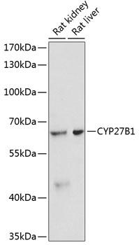 CYP27B1 Antibody - Western blot analysis of extracts of various cell lines using CYP27B1 Polyclonal Antibody at dilution of 1:3000.