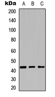 CYP27C1 Antibody - Western blot analysis of Cytochrome P450 27C1 expression in HEK293T (A); NIH3T3 (B); PC12 (C) whole cell lysates.