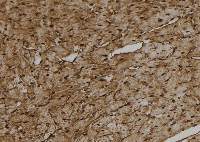 CYP27C1 Antibody - 1:100 staining rat heart tissue by IHC-P. The sample was formaldehyde fixed and a heat mediated antigen retrieval step in citrate buffer was performed. The sample was then blocked and incubated with the antibody for 1.5 hours at 22°C. An HRP conjugated goat anti-rabbit antibody was used as the secondary.