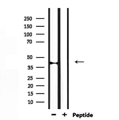 CYP27C1 Antibody - Western blot analysis of extracts of rat muscle using Cytochrome P450 27C1 antibody.