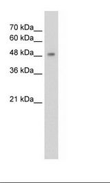 CYP2A13 Antibody - HepG2 Cell Lysate.  This image was taken for the unconjugated form of this product. Other forms have not been tested.