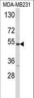 CYP2A13 Antibody - Western blot of CYP2A13 Antibody in MDA-MB231 cell line lysates (35 ug/lane). CYP2A13 (arrow) was detected using the purified antibody.