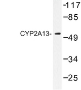 CYP2A13 Antibody - Western blot of CYP2A13 (N338) pAb in extracts from HeLa cells.