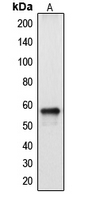 CYP2A13 Antibody - Western blot analysis of Cytochrome P450 2A13 expression in HepG2 (A) whole cell lysates.