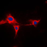 CYP2A13 Antibody - Immunofluorescent analysis of Cytochrome P450 2A13 staining in HepG2 cells. Formalin-fixed cells were permeabilized with 0.1% Triton X-100 in TBS for 5-10 minutes and blocked with 3% BSA-PBS for 30 minutes at room temperature. Cells were probed with the primary antibody in 3% BSA-PBS and incubated overnight at 4 C in a humidified chamber. Cells were washed with PBST and incubated with a DyLight 594-conjugated secondary antibody (red) in PBS at room temperature in the dark. DAPI was used to stain the cell nuclei (blue).