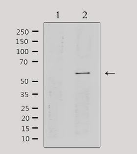 CYP2A13 Antibody - Western blot analysis of extracts of HepG2 cells using Cytochrome P450 2A13 antibody. Lane 1 was treated with the antigen-specific peptide.