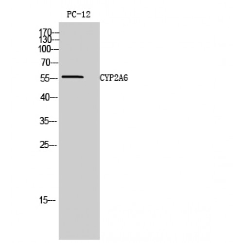 CYP2A6 Antibody - Western blot of CYP2A6 antibody