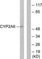 CYP2A6 Antibody - Western blot analysis of lysates from Jurkat cells, using Cytochrome P450 2A6 Antibody. The lane on the right is blocked with the synthesized peptide.