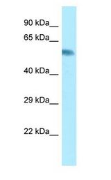 CYP2A6 Antibody - CYP2A6 antibody Western Blot of Fetal Small Intestine.  This image was taken for the unconjugated form of this product. Other forms have not been tested.