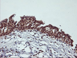 CYP2A6 Antibody - IHC of paraffin-embedded Human bladder tissue using anti-CYP2A6 mouse monoclonal antibody.