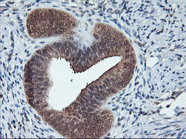 CYP2A6 Antibody - IHC of paraffin-embedded Human endometrium tissue using anti-CYP2A6 mouse monoclonal antibody.