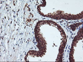 CYP2A6 Antibody - IHC of paraffin-embedded Human prostate tissue using anti-CYP2A6 mouse monoclonal antibody.