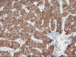 CYP2A6 Antibody - IHC of paraffin-embedded Human liver tissue using anti-CYP2A6 mouse monoclonal antibody.