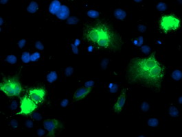 CYP2A6 Antibody - Anti-CYP2A6 mouse monoclonal antibody immunofluorescent staining of COS7 cells transiently transfected by pCMV6-ENTRY CYP2A6.