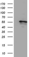 CYP2A6 Antibody - HEK293T cells were transfected with the pCMV6-ENTRY control (Left lane) or pCMV6-ENTRY CYP2A6 (Right lane) cDNA for 48 hrs and lysed. Equivalent amounts of cell lysates (5 ug per lane) were separated by SDS-PAGE and immunoblotted with anti-CYP2A6.