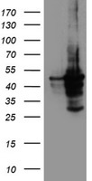CYP2A6 Antibody - HEK293T cells were transfected with the pCMV6-ENTRY control (Left lane) or pCMV6-ENTRY CYP2A6 (Right lane) cDNA for 48 hrs and lysed. Equivalent amounts of cell lysates (5 ug per lane) were separated by SDS-PAGE and immunoblotted with anti-CYP2A6.