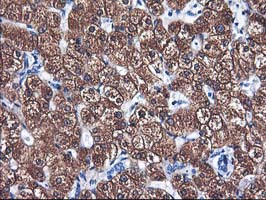 CYP2A6 Antibody - IHC of paraffin-embedded Human liver tissue using anti-CYP2A6 mouse monoclonal antibody. (Heat-induced epitope retrieval by 10mM citric buffer, pH6.0, 100C for 10min).