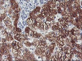CYP2A6 Antibody - IHC of paraffin-embedded Human liver tissue using anti-CYP2A6 mouse monoclonal antibody. (Heat-induced epitope retrieval by 10mM citric buffer, pH6.0, 100C for 10min).