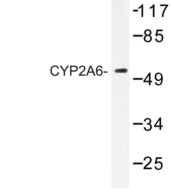CYP2A6 Antibody - Western blot of CYP2A6 (E131) pAb in extracts from Jurkat cells.