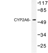 CYP2A6 Antibody - Western blot of CYP2A6 (E131) pAb in extracts from Jurkat cells.