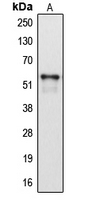 CYP2A6 Antibody - Western blot analysis of Cytochrome P450 2A6 expression in HepG2 (A) whole cell lysates.