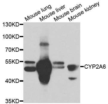 CYP2A6 Antibody - Western blot analysis of extracts of various cell lines.