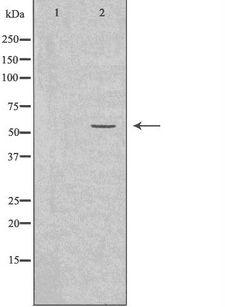 CYP2A6 Antibody - Western blot analysis of extracts of Jurkat cells using Cytochrome P450 2A6 antibody. The lane on the left is treated with the antigen-specific peptide.