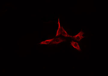 CYP2A6 Antibody - Staining HeLa cells by IF/ICC. The samples were fixed with PFA and permeabilized in 0.1% Triton X-100, then blocked in 10% serum for 45 min at 25°C. The primary antibody was diluted at 1:200 and incubated with the sample for 1 hour at 37°C. An Alexa Fluor 594 conjugated goat anti-rabbit IgG (H+L) antibody, diluted at 1/600, was used as secondary antibody.